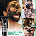 Acne Peel-Off Mask - Charcoal Facial Cleanser for Blackhead Removal & Clear Skin