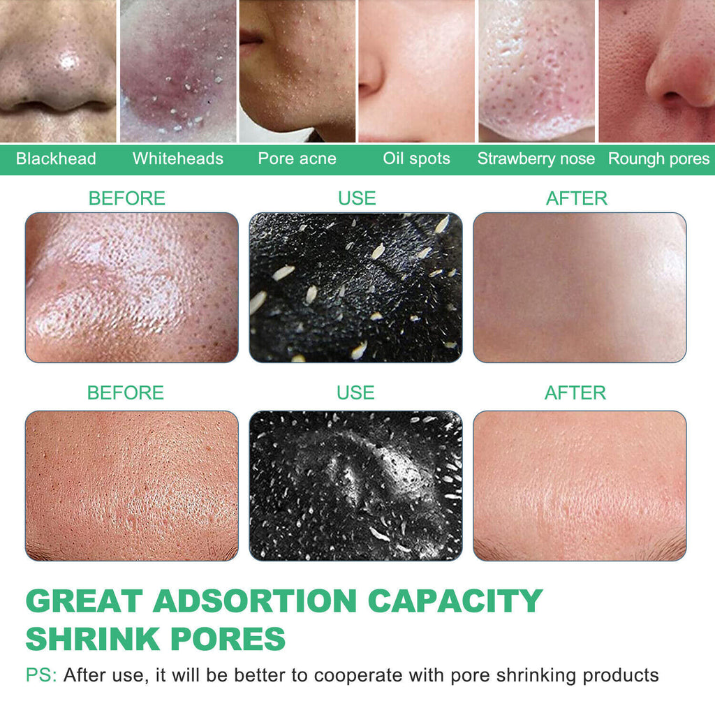 Purifying Acne Peel-Off Mask ​Facial Cleansing Blackhead Remover Charcoal Mask