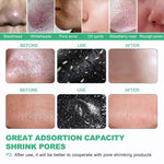 Acne Peel-Off Mask - Charcoal Facial Cleanser for Blackhead Removal & Clear Skin
